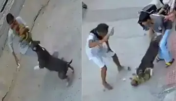 Pet dog attacks 6-month-old infant