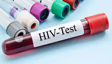 HIV scare in Medak... 5,402 affected individuals.