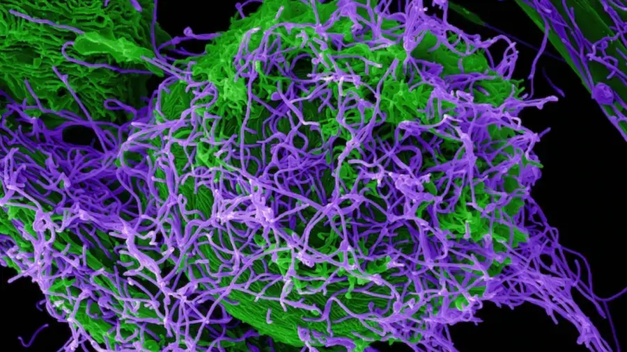 ebola