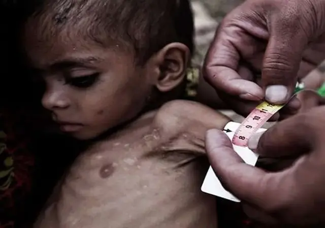 hunger