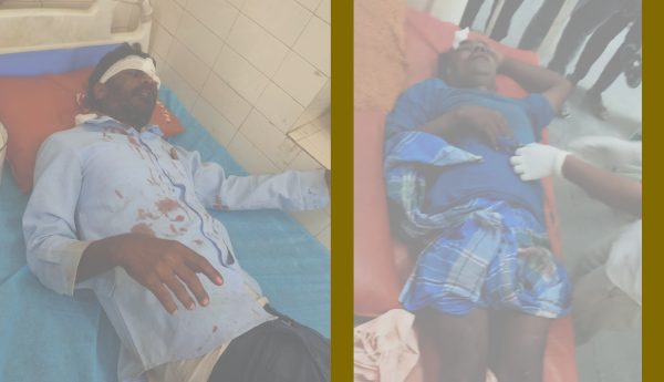 https://prajasakti.com/district-news/two-people-were-seriously-injured-in-the-road-accident