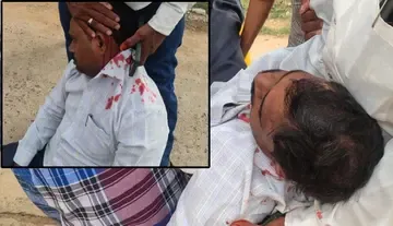 టిడిపి దాడిలో గాయపడ్డ సిపిఎం నాయకులు టి.ఆవులయ్య