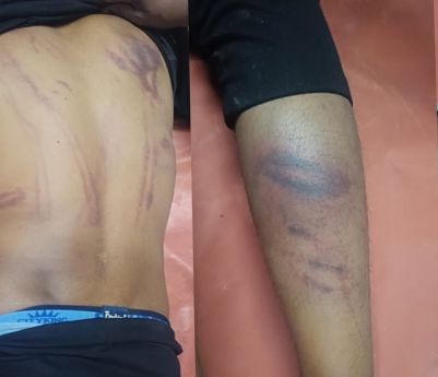 Attack on Bihar youth – Attempted murder