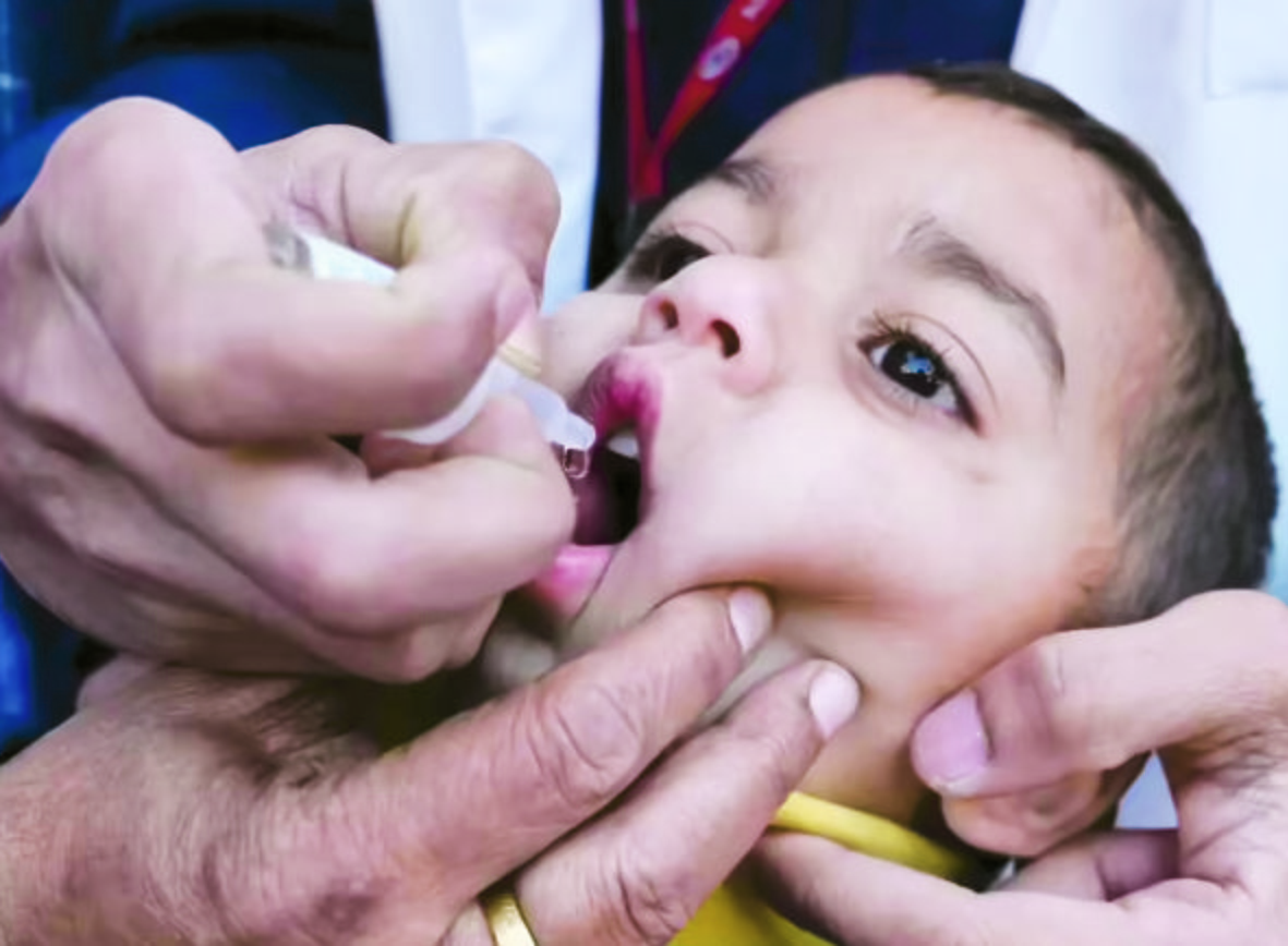 pulse polio