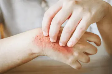 skin